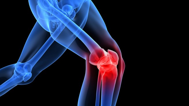 Knee pain image showing discomfort around the joint