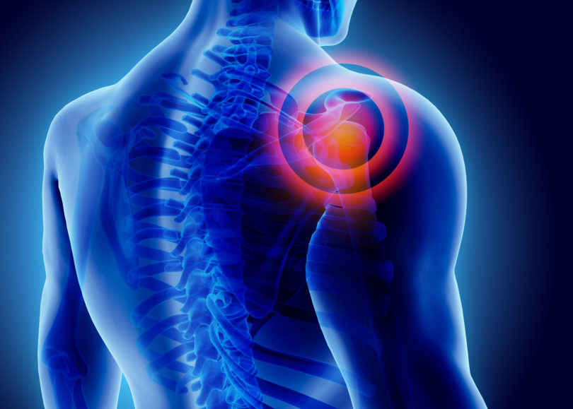 Neck & Shoulder Pain