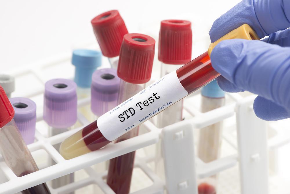 I Think I Have an STD: What Should I Do?